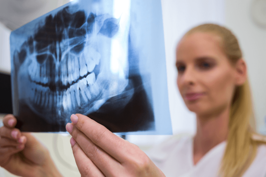 X-ray for Dental Staff