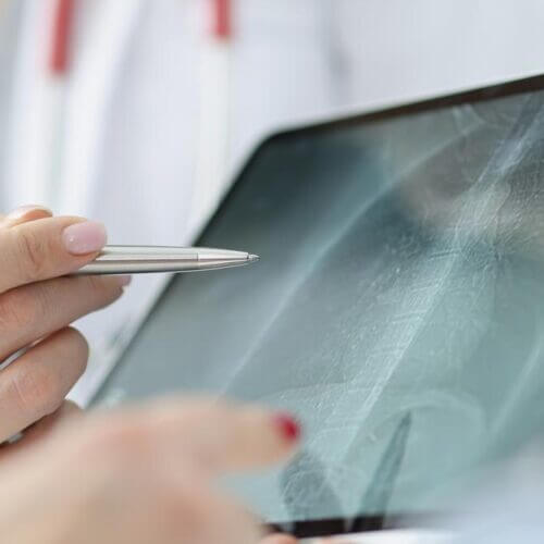 Pneumonia in Healthcare Settings