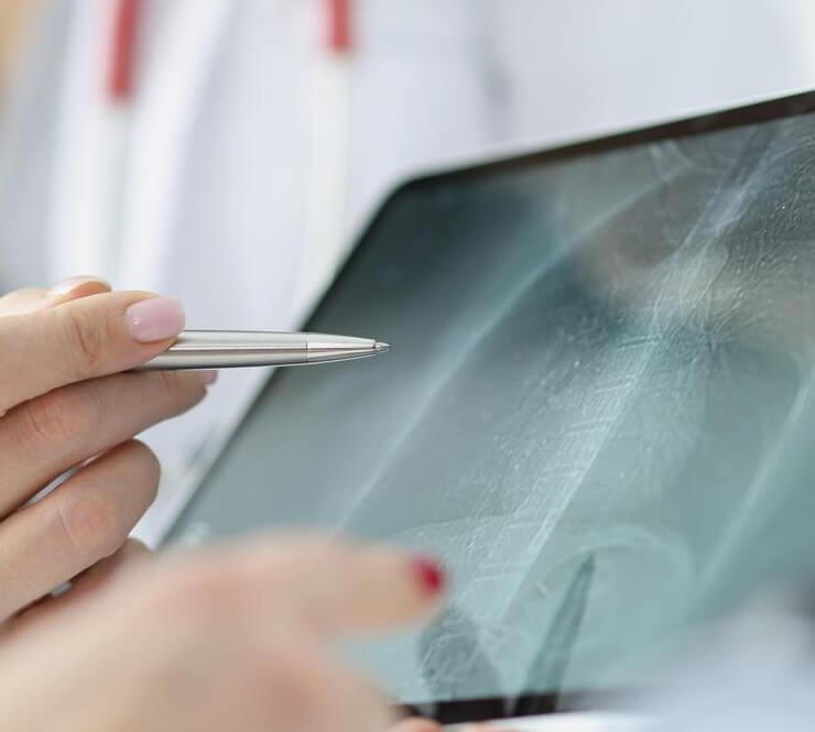doctor shows patient xray lungs tablet lung inflammation pneumonia concept 151013 32346 1